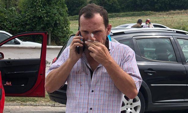 Aile hekimi hastasının bastonla saldırısına uğradı