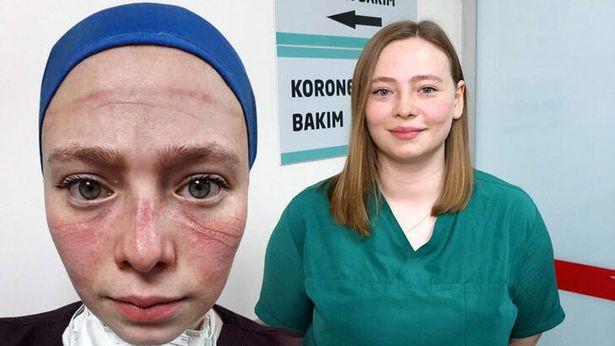 Salgınla mücadelenin simgesi Seher hemşire: Maske kalktı ama izi ve hatıraları bizimle
