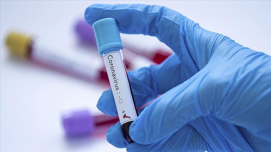 Araştırma: Midkin protein seviyesi koronavirüsün yeni belirtisi olabilir