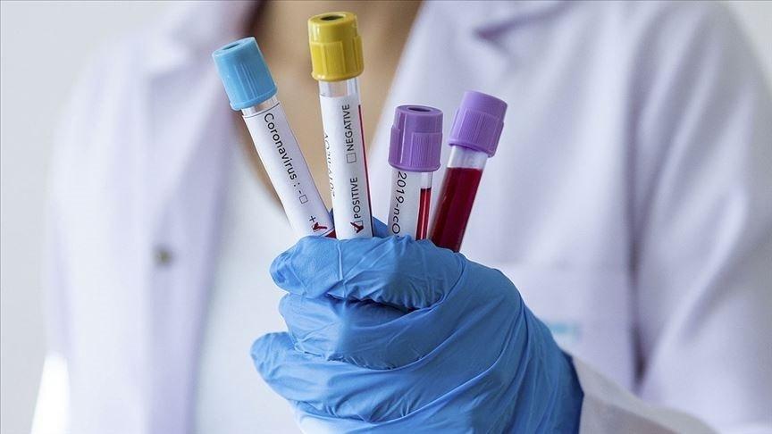 İlk 'uzun Covid' testi yolda!