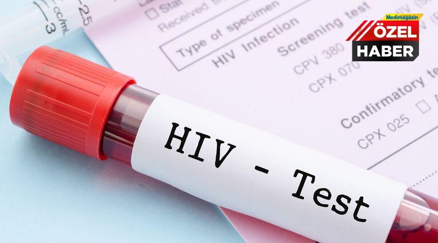 AIDS'te yeni tedavi umudu: Enfekte hücreler HIV'den kurtarıldı!