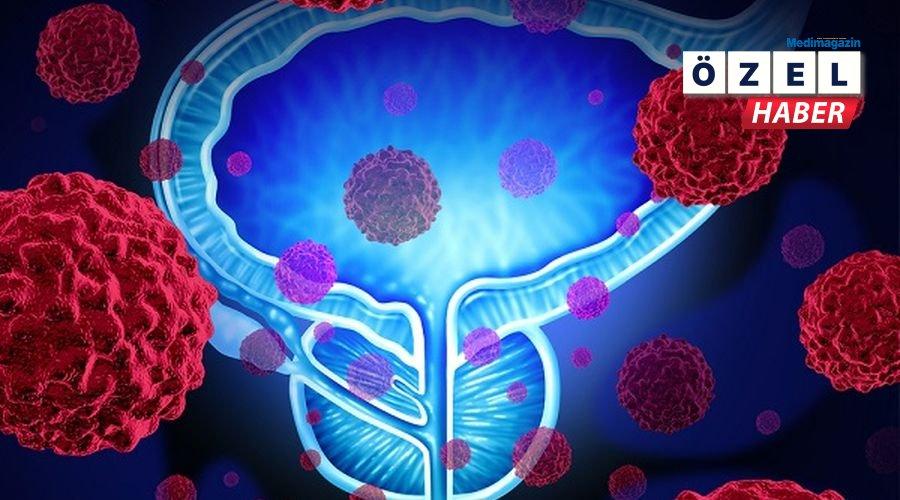 Tahminler, prostat vakalarının 2050 yılında %25 artacağını gösteriyor