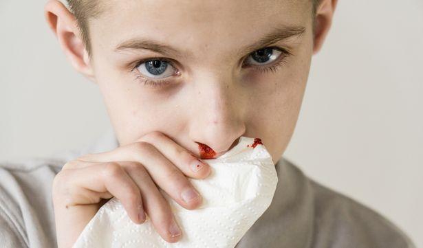 Okul kazalarında dikkat edilmesi gerekenler 