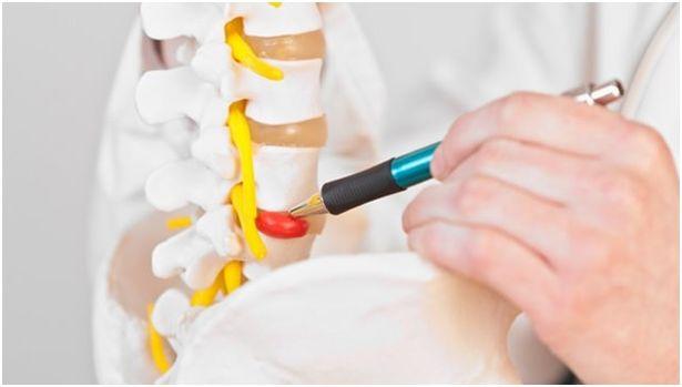 Bel fıtığı nedir? Tedavisinde nelere dikkat edilmelidir?