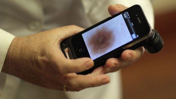 Kanser teşhisinde yapay zeka insandan daha isabetli teşhisler yaptı 