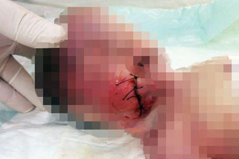 Radikal muhabiri Cerrahpaşa'daki fotoğrafı nasıl çektiğini anlattı