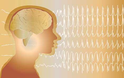 Epilepsi hastalarına ameliyat müjdesi