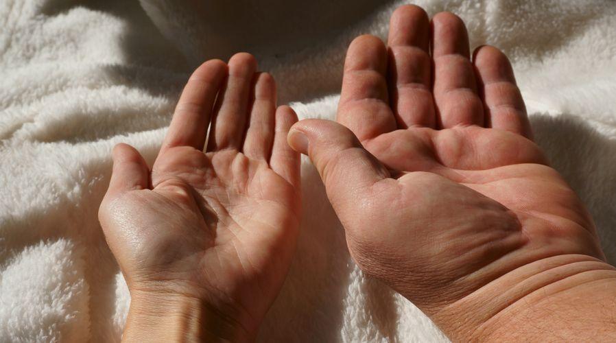 Akromegali nedir? Akromegali hastalığının tedavisi var mı?