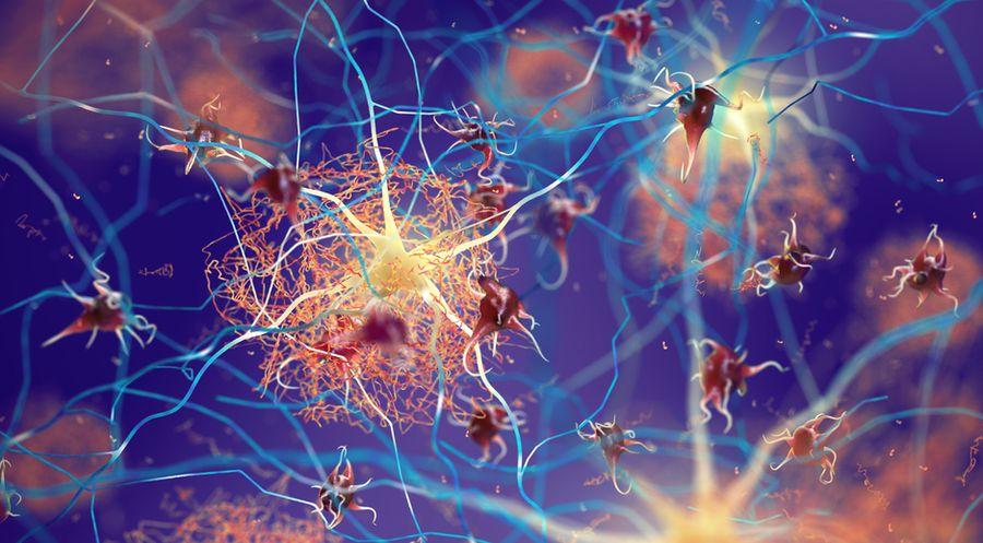 Burun spreyi, Alzheimer hastalığına neden olan proteinleri temizleyebilir mi?