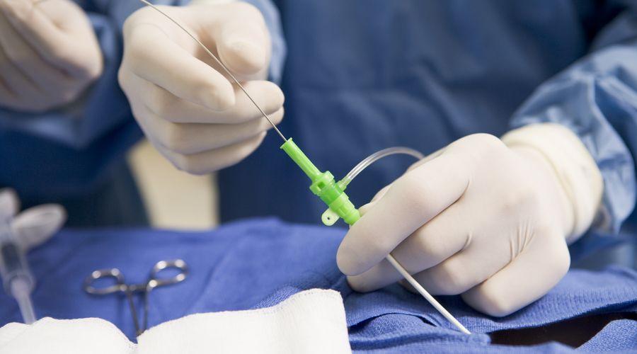 İyi huylu prostat büyümesinde anjiyo ile tedavi mümkün