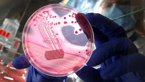 Antibiyotik direncin kontrol altına alınması için ne yapılmalı?