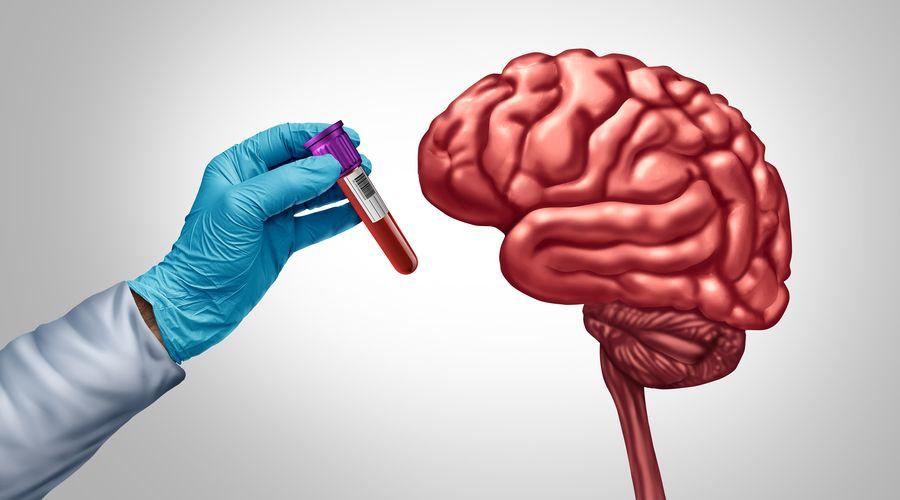 Çığır açan kan testi Alzheimer hastalığının daha basit ve doğru teşhisini sağlıyor