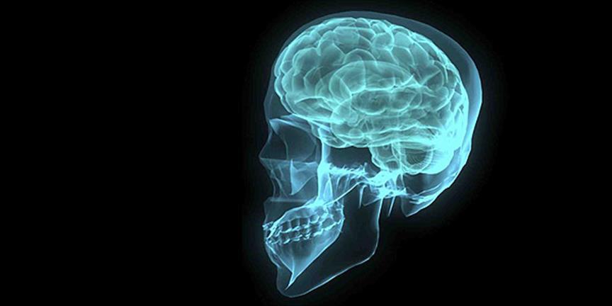 Bilim insanları beyin tümörlerini yok edebilen implant geliştirdi