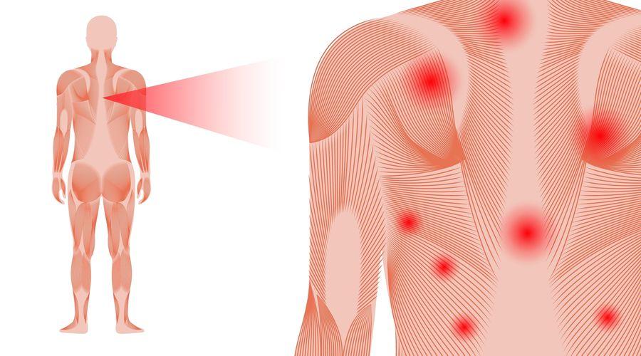 Fibromiyaljide dikkat edilmesi gereken 5 önemli nokta!