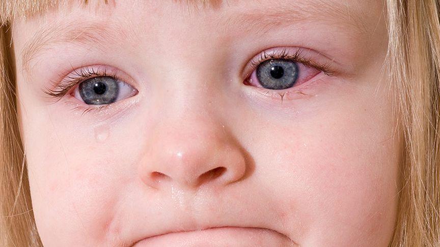 Yeni COVID varyantı farklı bir semptom ortaya koyuyor