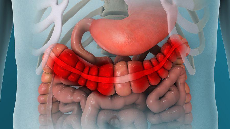 Prof. Dr. Murat Törüner: İBH’de kronik inflamasyonu durdurmak tedavinin temelidir