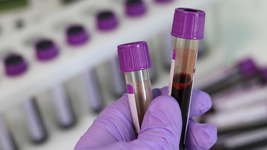 Yeni kan testi 18 farklı kanser türünü en erken evrede tespit ediyor