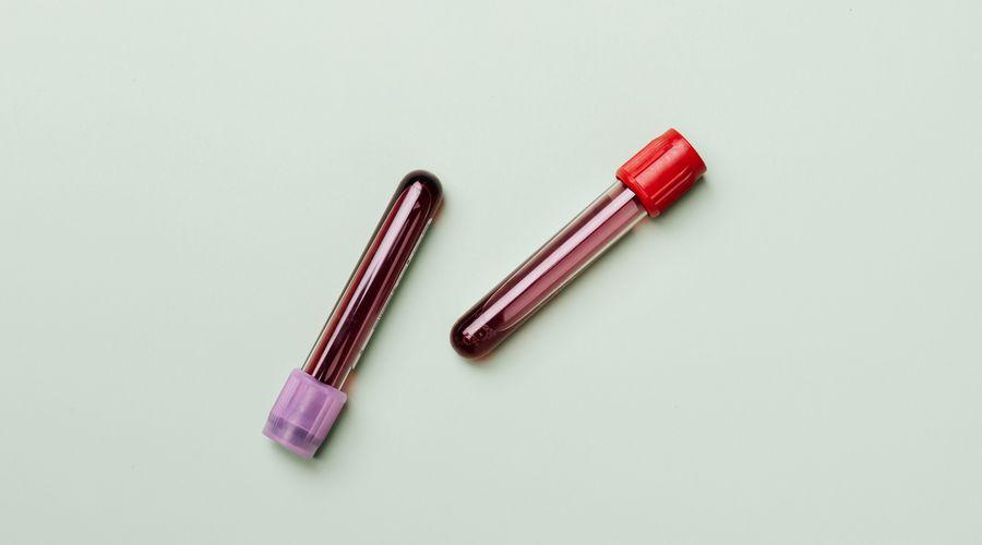 Diyabette HBA1C neden önemlidir?