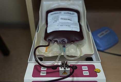 Kan nakli nedeni ile doğar doğmaz HIV bulaştı, şimdi 21 yaşında