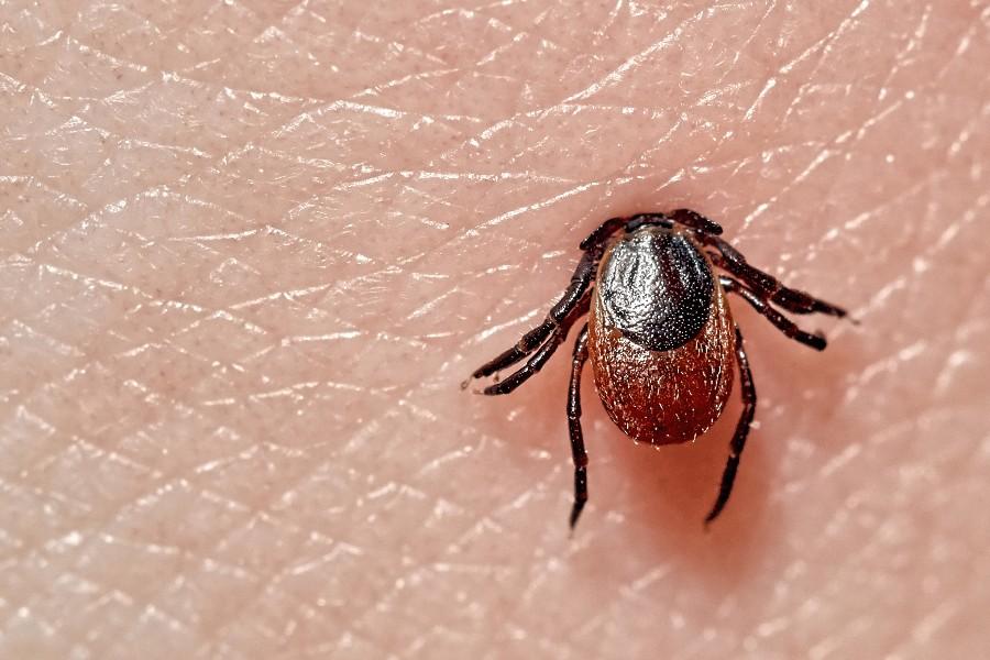 ABD'de yayılan gizemli hastalığı doktorlar bile tanımıyor: Alfa-Gal Sendromu