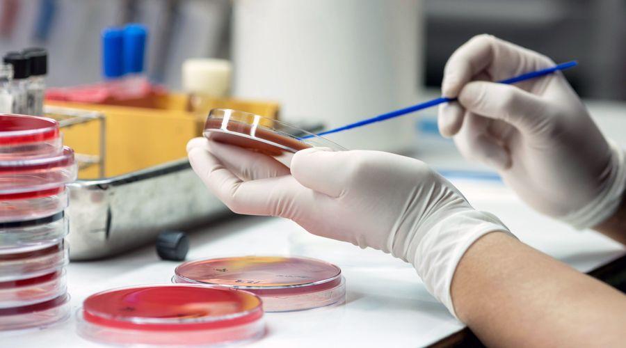 Candida auris: ABD'de hastanelerde hızla yayılan ilaca dirençli mantar