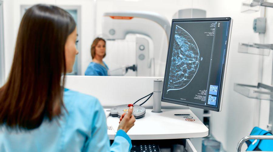 Yeni bir araştırma 'kanser taraması hayat kurtarır' sloganını sorguluyor
