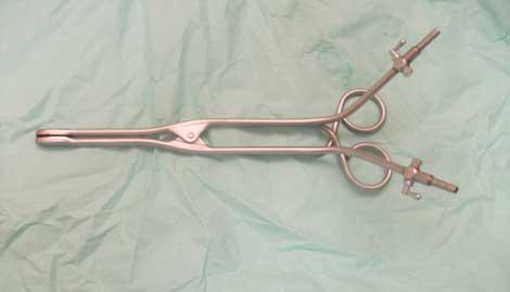 Parçayı patolojiye göndermeyen doktordan 45 bin Tl tazminat kazandı