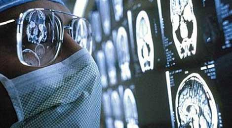 Temporal lob epilepsi nedir? (Yavuz Yılmaz'ın hastalığı temporal lob epilepsi felç yapar mı?)