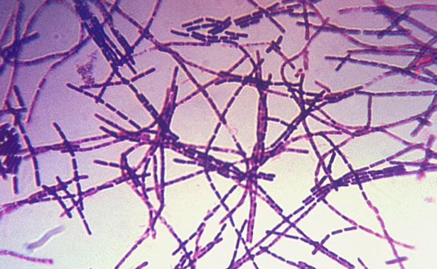 Şarbon hastalığı nedir? Klinik belirtileri nasıldır? Tedavisi nasıl yapılır?