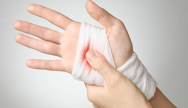 Bilim adamları renk değiştiren sargı bezi geliştirdi