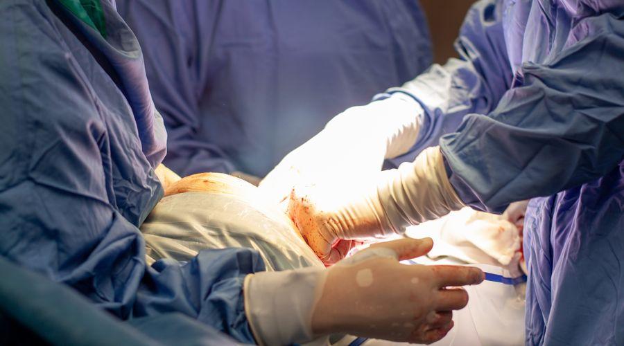 Yeni çalışma sezaryen sonrası kadınlarda doğurganlığın azaldığını gösteriyor