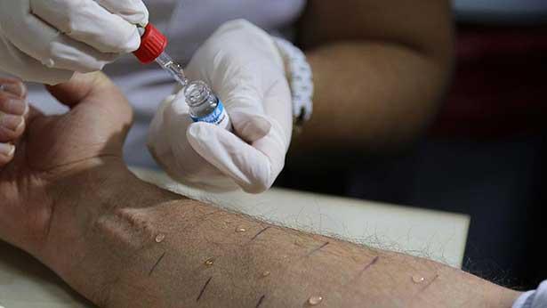 Ulusal Alerji ve Klinik İmmünoloji Derneği Başkanı: ' Besin endüstrisi alerjilerde etken' 
