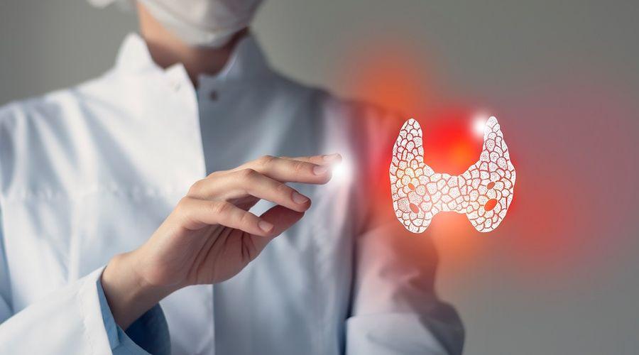Tiroid ile ilgili merak edilen 10 soru ve yanıtı