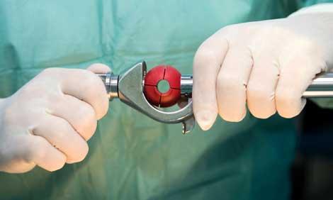 Testis tümörleri, 20-35 yaş arasında sık görülüyor