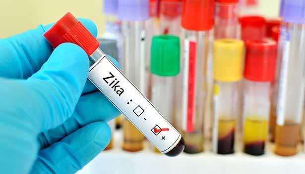 Zika vürüsü 'Guillain-Barré Sendromu'na neden olabilir'