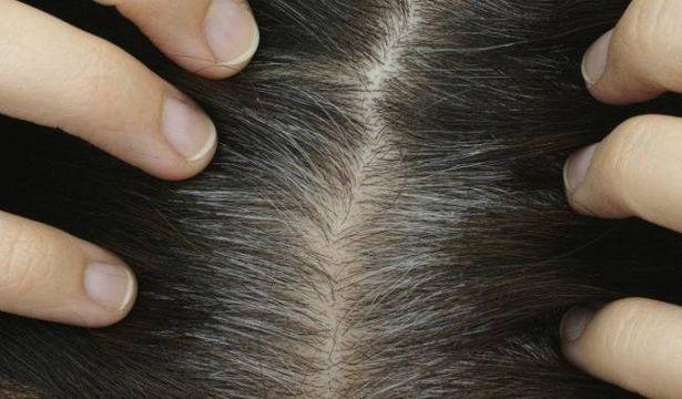 Araştırma: Stresin saçları nasıl beyazlattığı ortaya çıktı