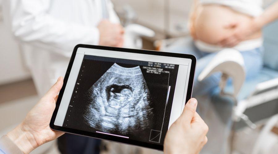 Yenilikçi akıllı stetoskop, hamile ve yeni doğum yapmış kadınlarda peripartum kardiyomiyopatiyi tespit ediyor
