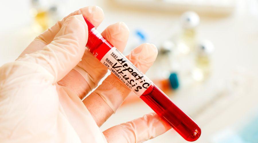 İngiltere, Hepatit-C'yi ortadan kaldıran ilk ülke olacak