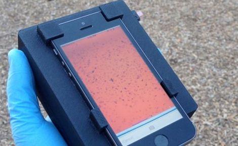 Kandaki parazitleri görüntüleyen akıllı telefon : CellScope