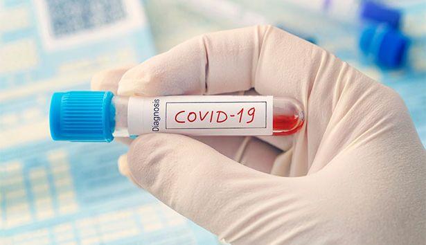Rusya’da son 24 saatte 10 bin 598 yeni koronavirüs vakası