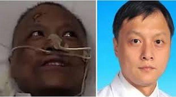 Dünyanın konuştuğu Çinli doktor hayatını kaybetti! Koronavirüs tedavisinden sonra ten rengi değişmişti