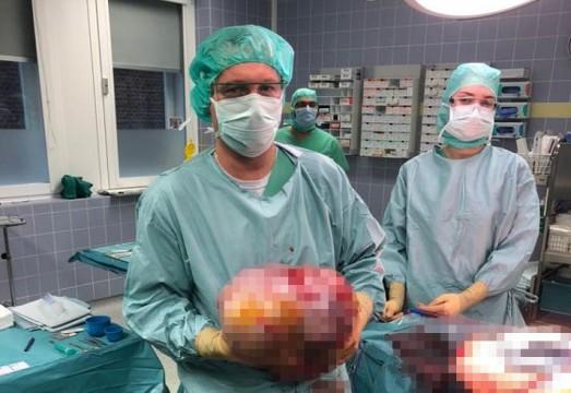 Hastadan 10.2 kilogram ağırlığında yumurtalık tümörü alındı