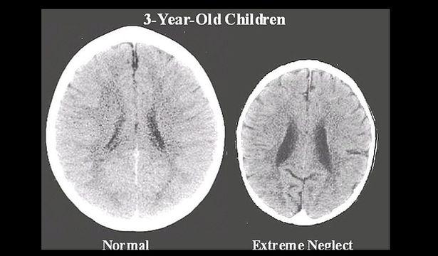 Araştırma: Aile ilgisi alamayan çocuk beyin gelişimini tamamlayamıyor