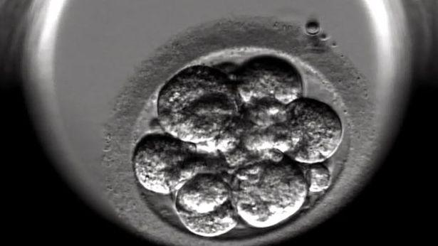 İngiliz çift ölen çocuklarının sperminden suni dölleme ile torun sahibi oldu 