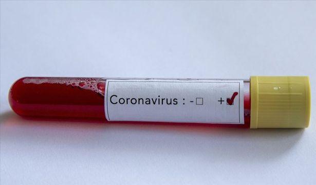 Dünya genelinde koronavirüs bilançosu: Can kaybı 316 bin 732’ye yükseldi 