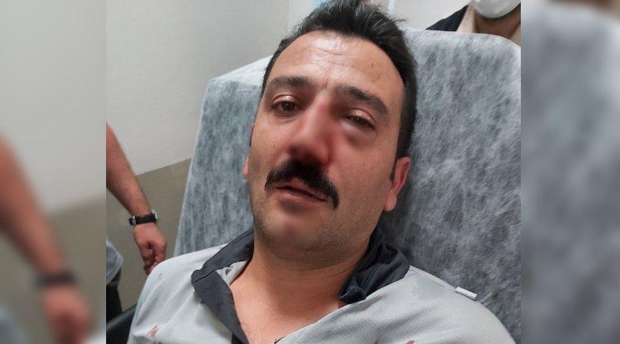 Sancaktepe'de hastane saldırısı! Hasta yakınları dehşet saçtı: Kafa atıp burnunu kırdılar