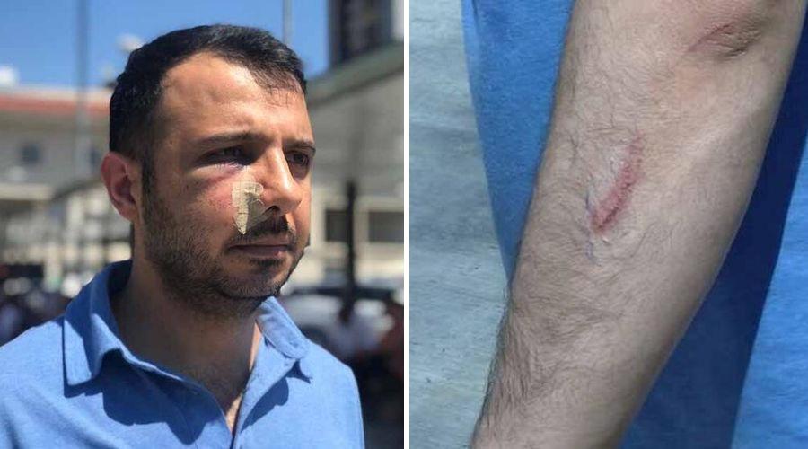 İstanbul'da sağlık çalışanına saldırı: Elmacık kemikleri kırıldı