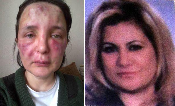 Yüzüne dolgu yaptığı kadını tanınmaz hale getiren sahte doktora 3 yıl 4 ay hapis
