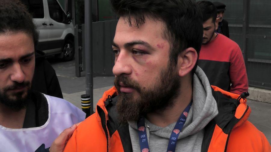 İstanbul'da hemşireye saldırı! 'Eldivenin kirli' bahanesiyle darbettiler