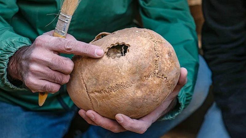 Van’da 3 bin 200 yıl öncesine ait beyin ameliyatı izine rastlandı